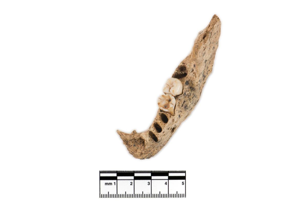 Neolithic human remains