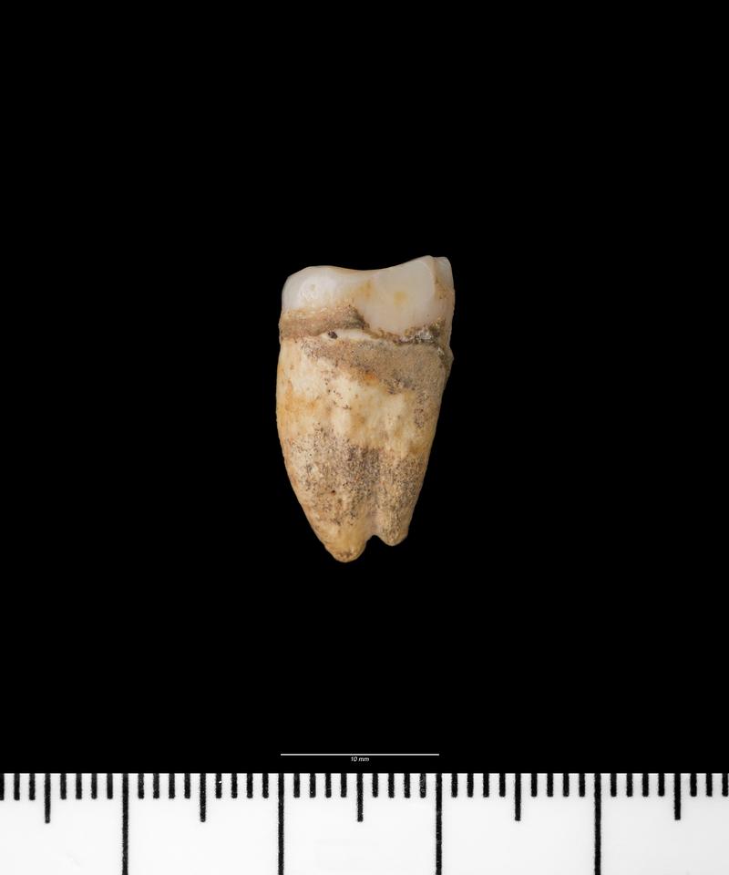 Prehistoric human tooth