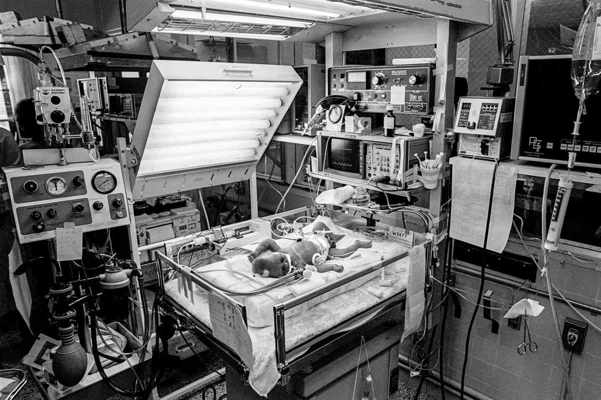 Preemie Baby unit at St Joseph&#039;s Hospital. I.C.U. The technology in a modern hospital. Showing IV Pump. Cardiac &amp; Respiratory monitor. Respirator. Umbilical catheter in navel. 3 Electrodes for heart &amp; respiratory rate, endotracheal tube in nose. Preemie baby under 2 lb at birth.