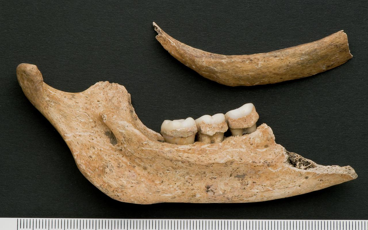 Left upper second molar - human