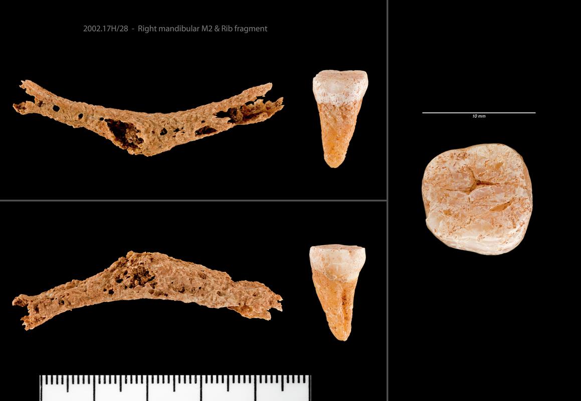Early Medieval human remains