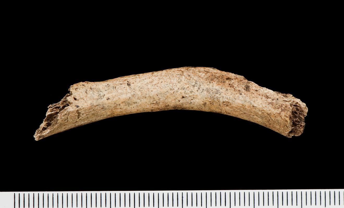 Early Medieval human remains