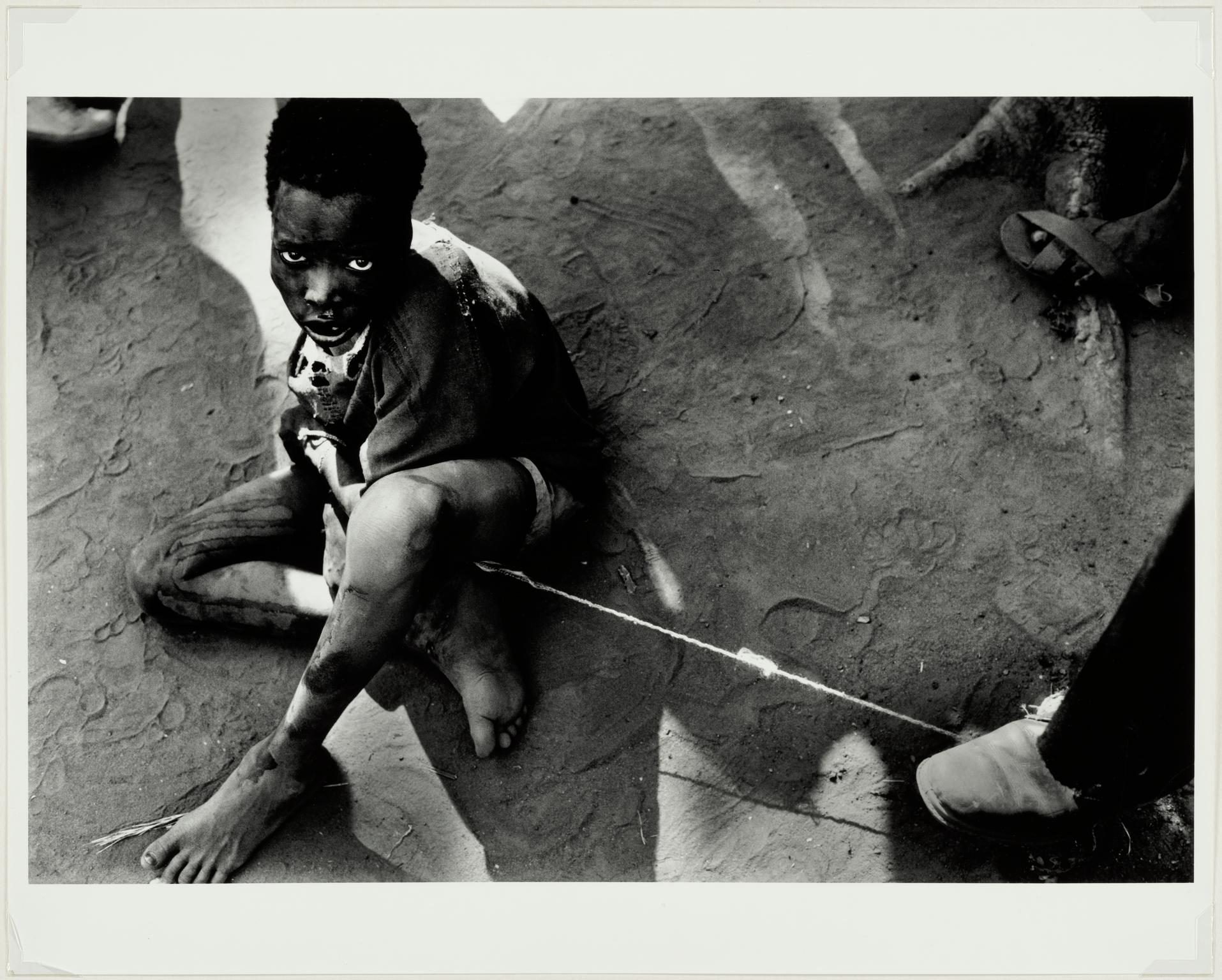 Demented boy, Sudan, 1988