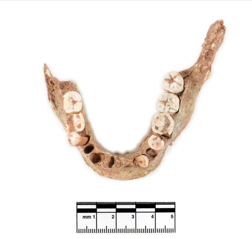 Neolithic human remains