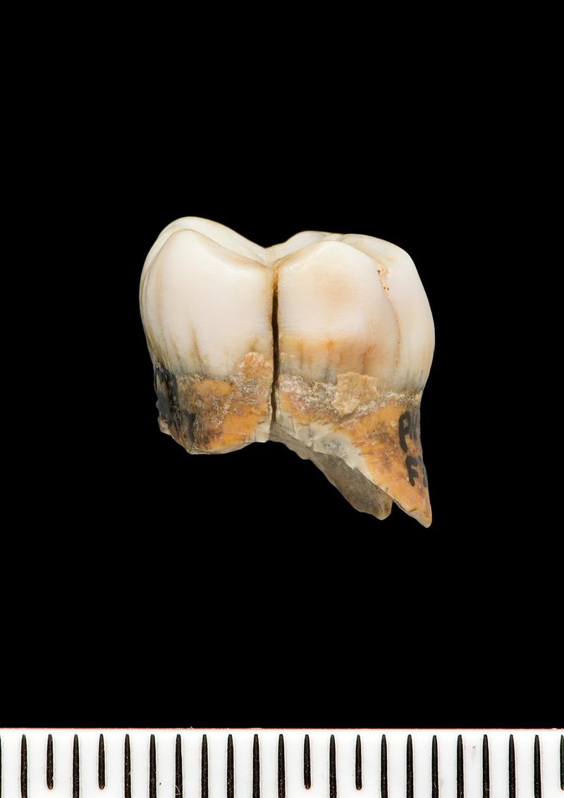 Lower Palaeolithic Neanderthal molar