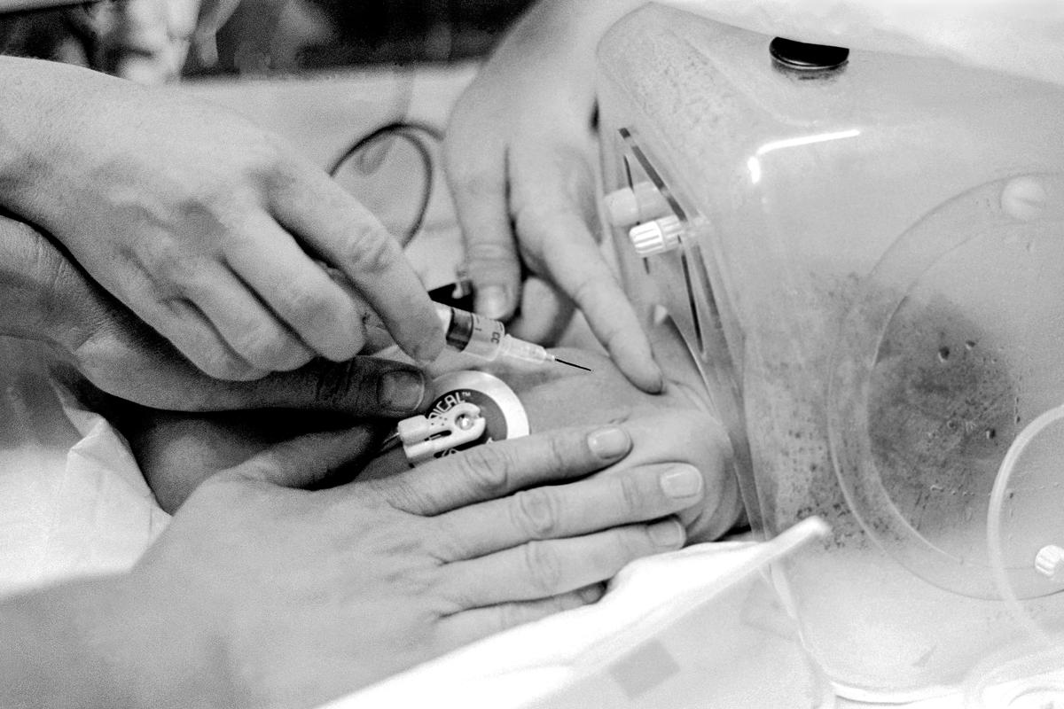 Preemie Baby unit at St Joseph&#039;s Hospital. I.C.U. Isolette. Preemie baby with head in a humidifier is injected to help stabilise it&#039;s condition. Phoenix, Arizona USA