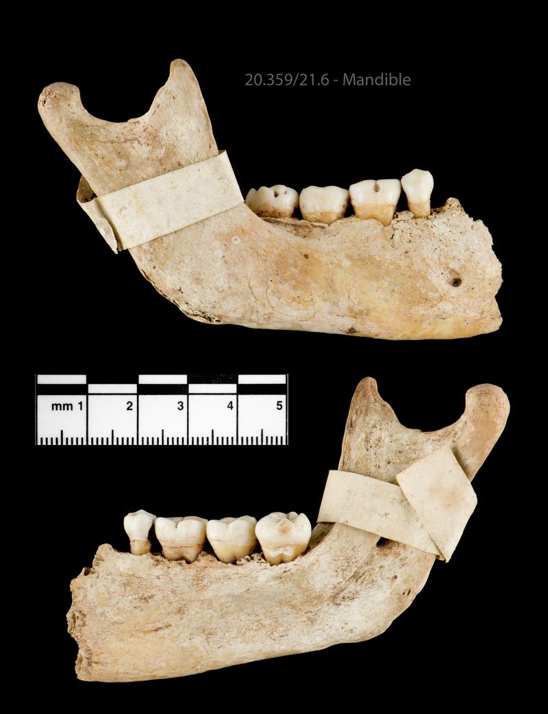 Prehistoric human bone