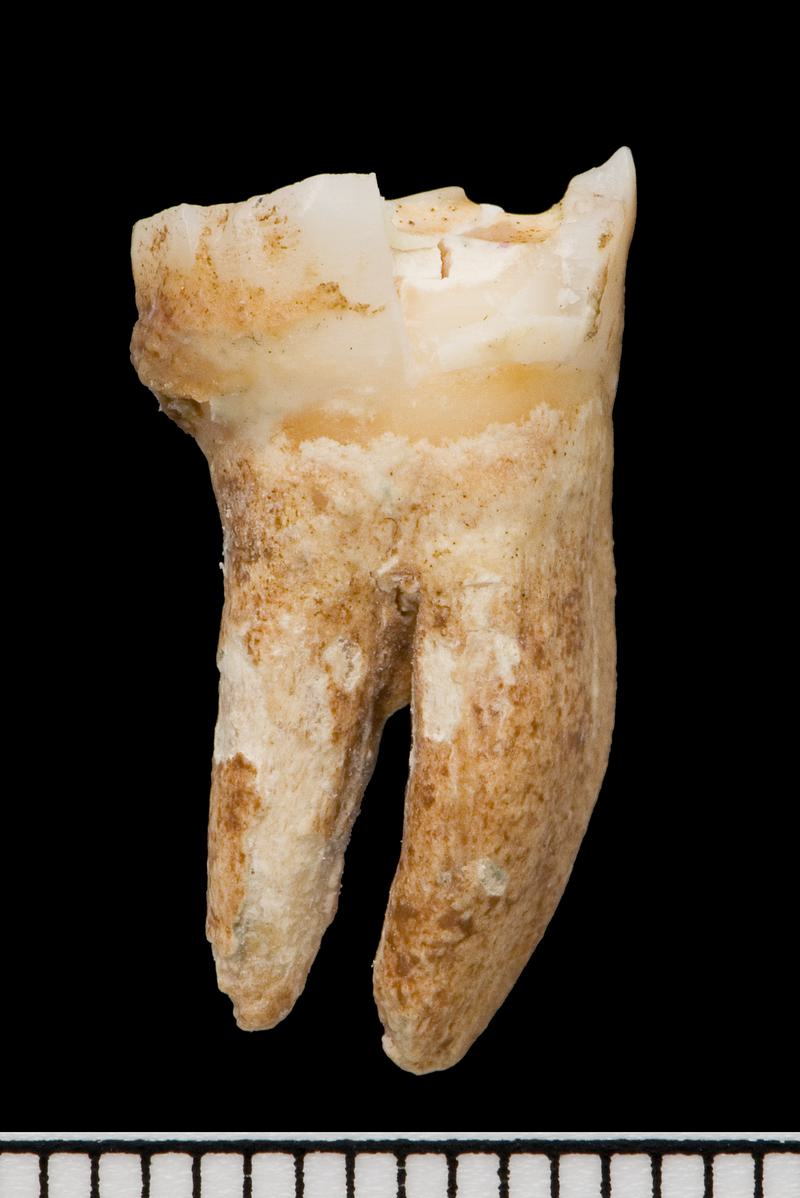 Roman human remains