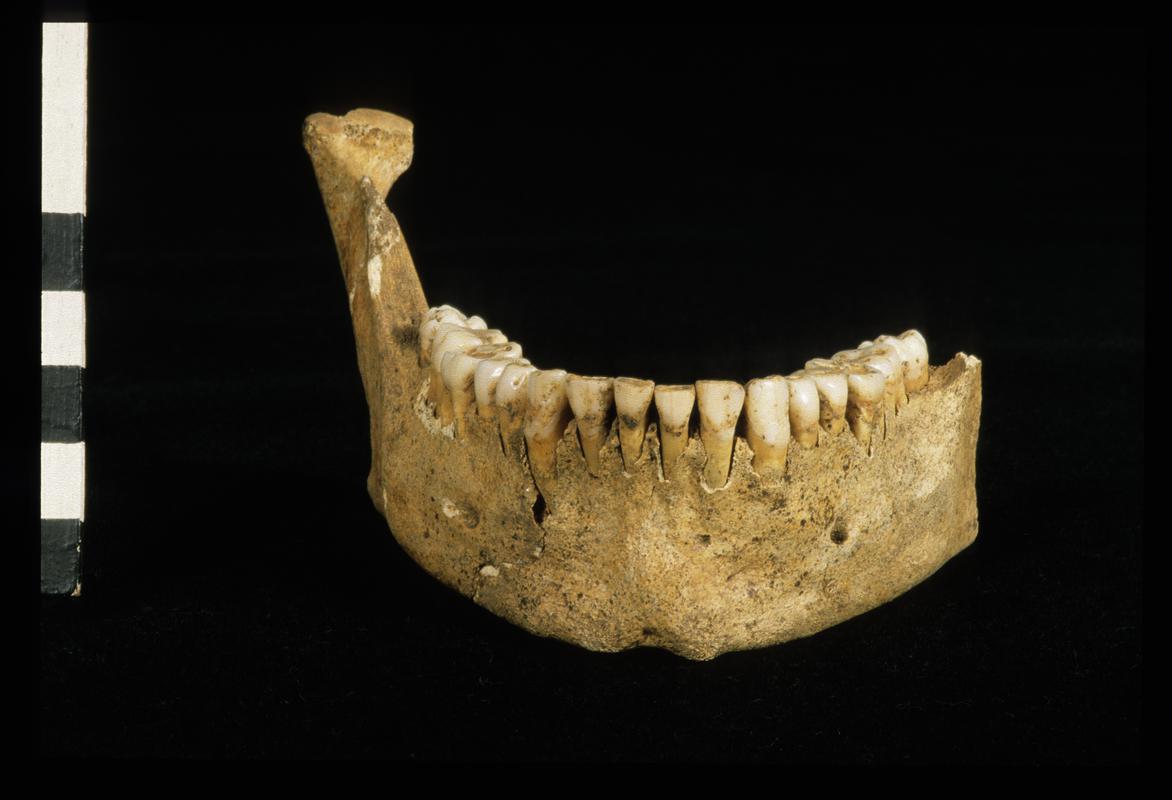 Early Medieval human remains