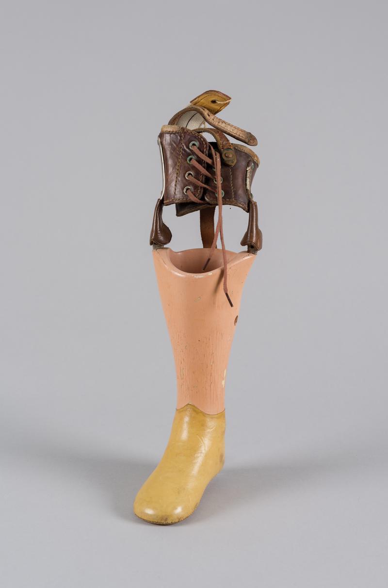 Child&#039;s prosthetic leg, 1955