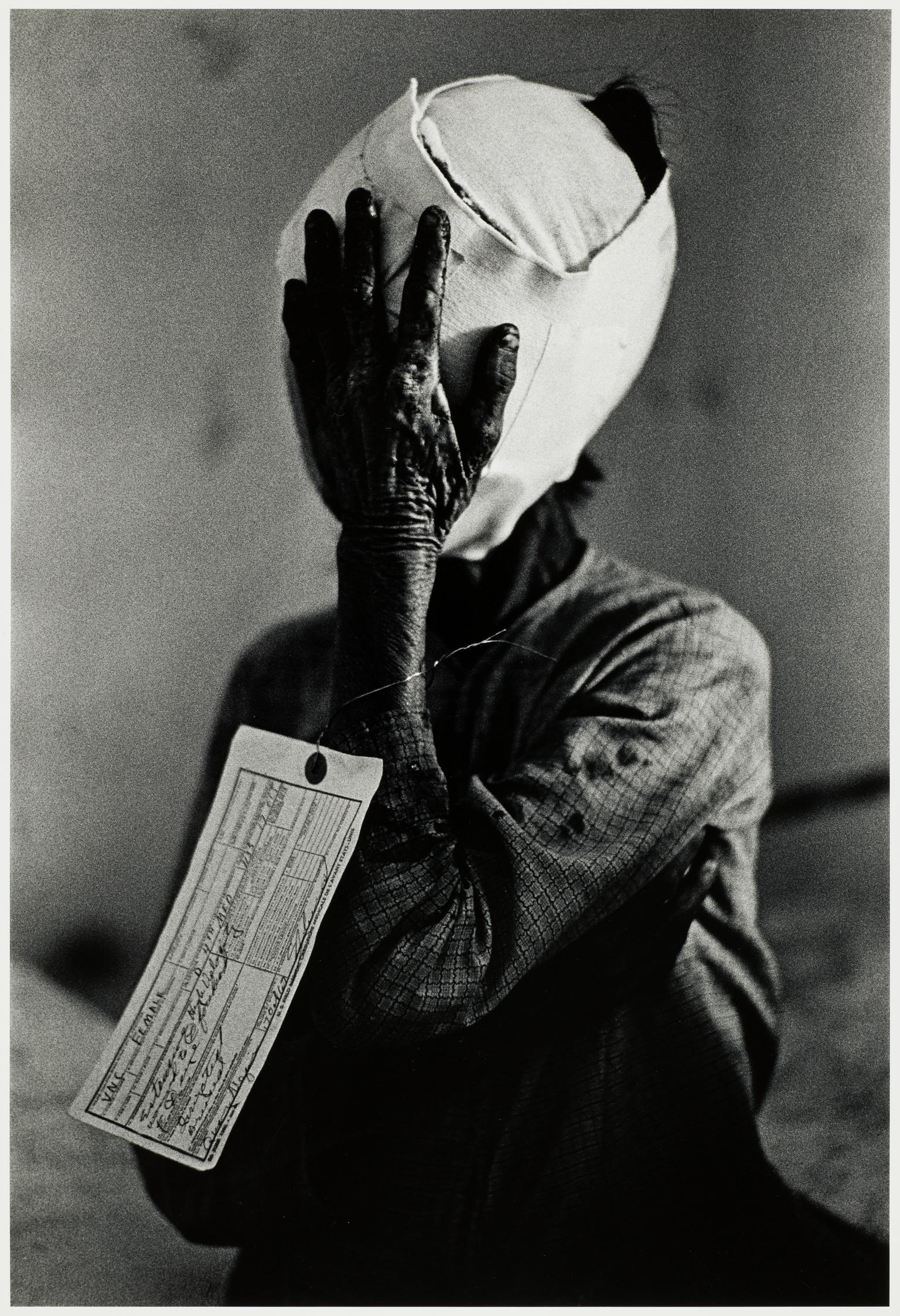 Civilian Victim, Vietnam, 1967