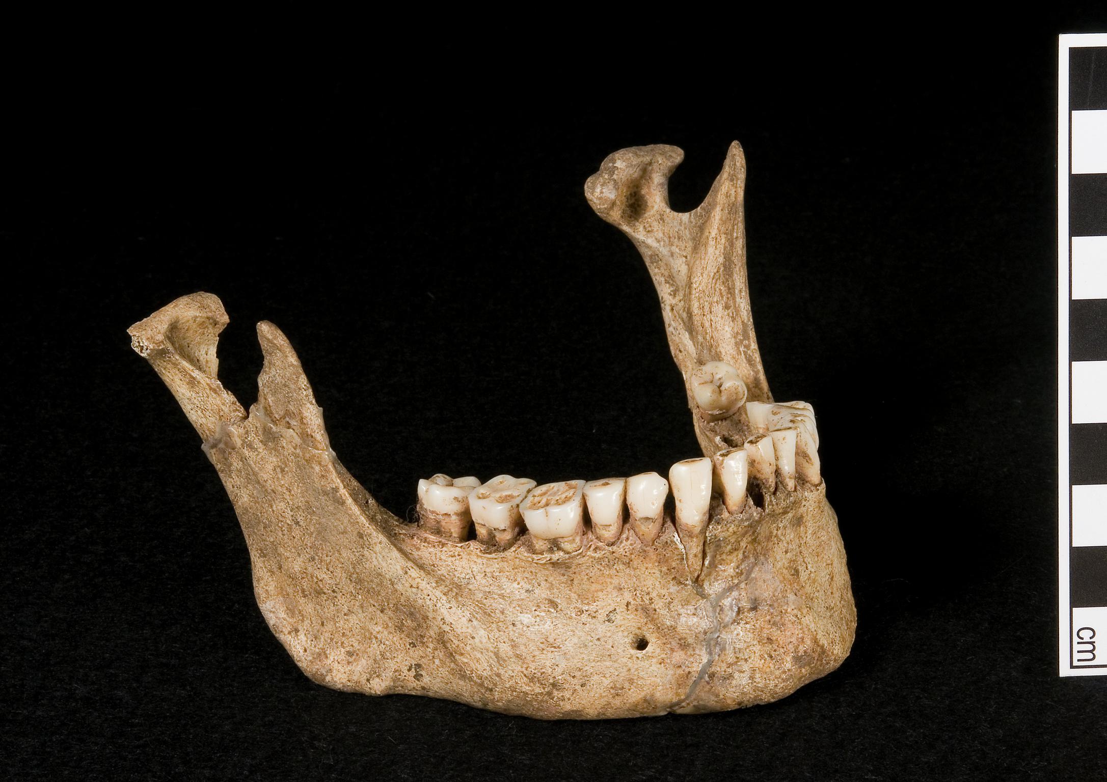 Early Medieval human remains