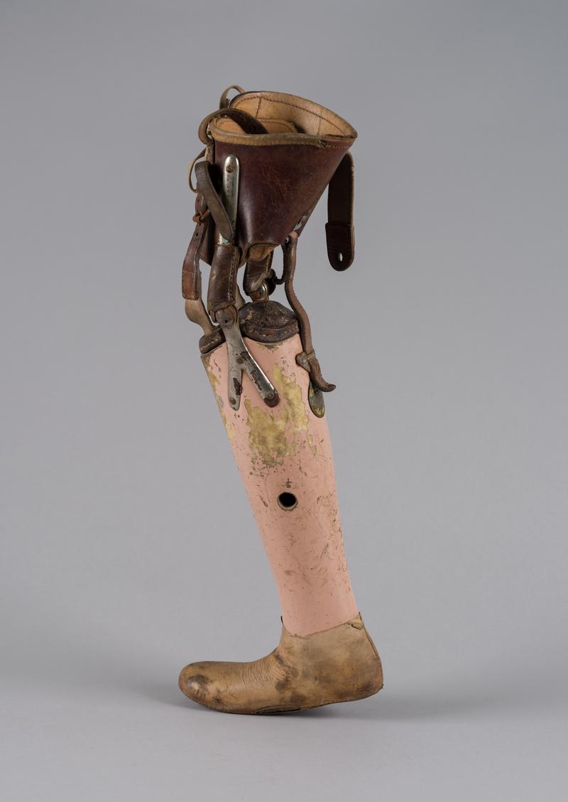 Child&#039;s prosthetic leg, 1958