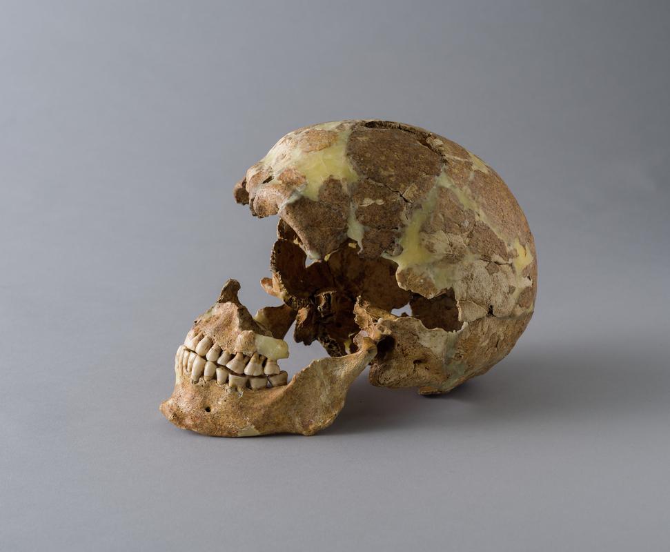 Early Medieval human remains