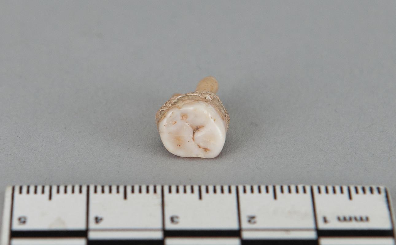 Early Medieval human remains