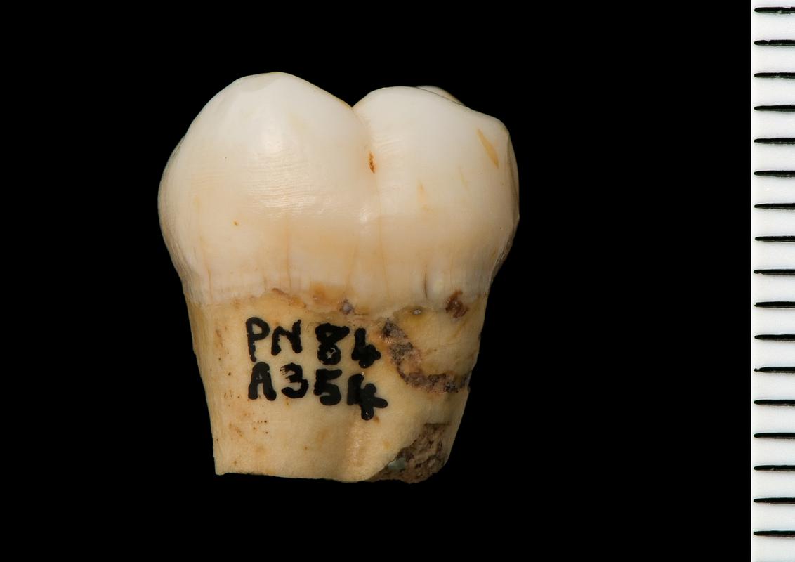 Lower Palaeolithic Neanderthal molar