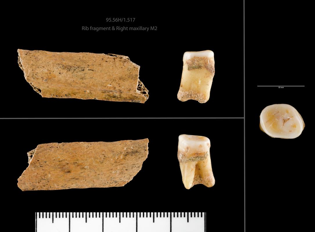 Rib fragment &amp; Right maxillary M2