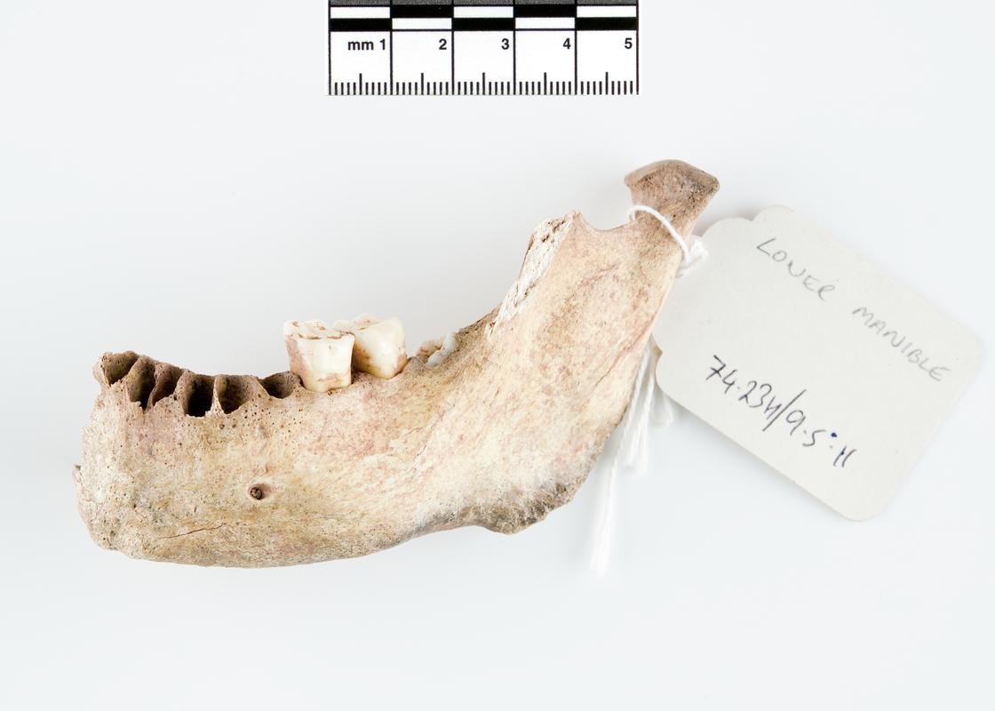 Neolithic human remains