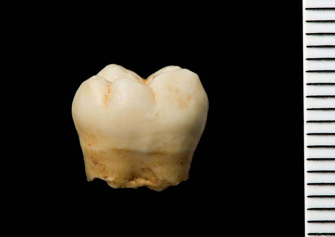 Mesolithic human remains