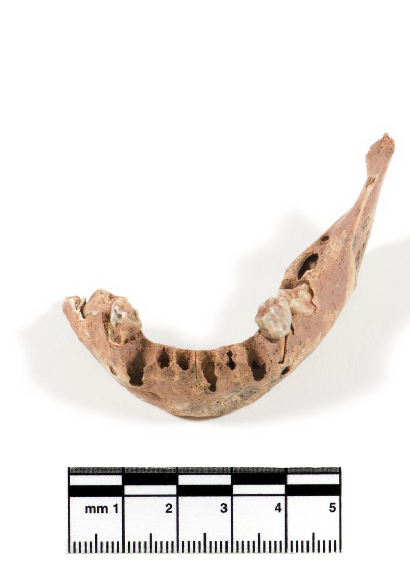 human mandible