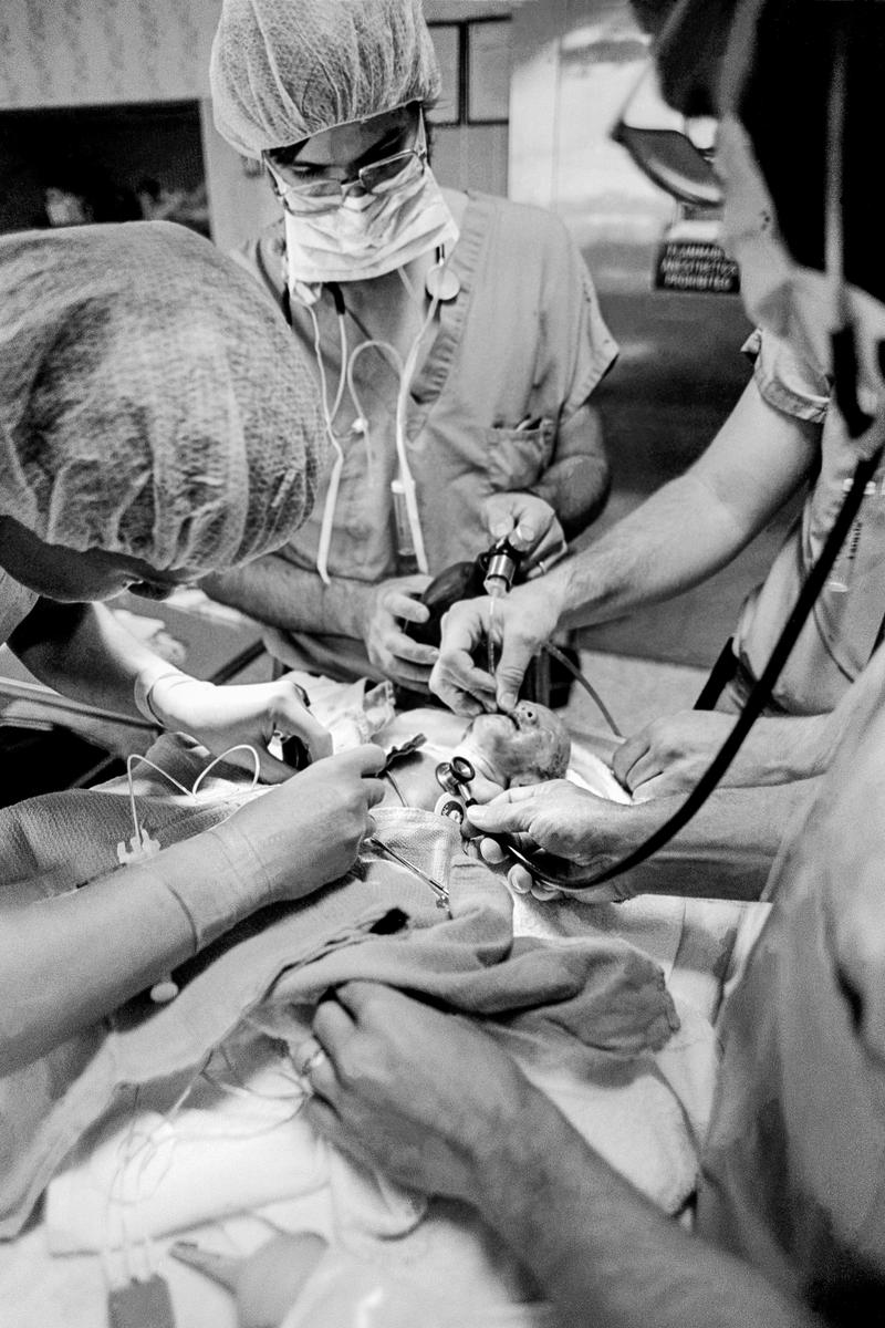 Preemie Baby unit at St Joseph&#039;s Hospital. Working within minutes on the birth of a preemie baby. An endotracheal tube and umbilical catheter being inserted.