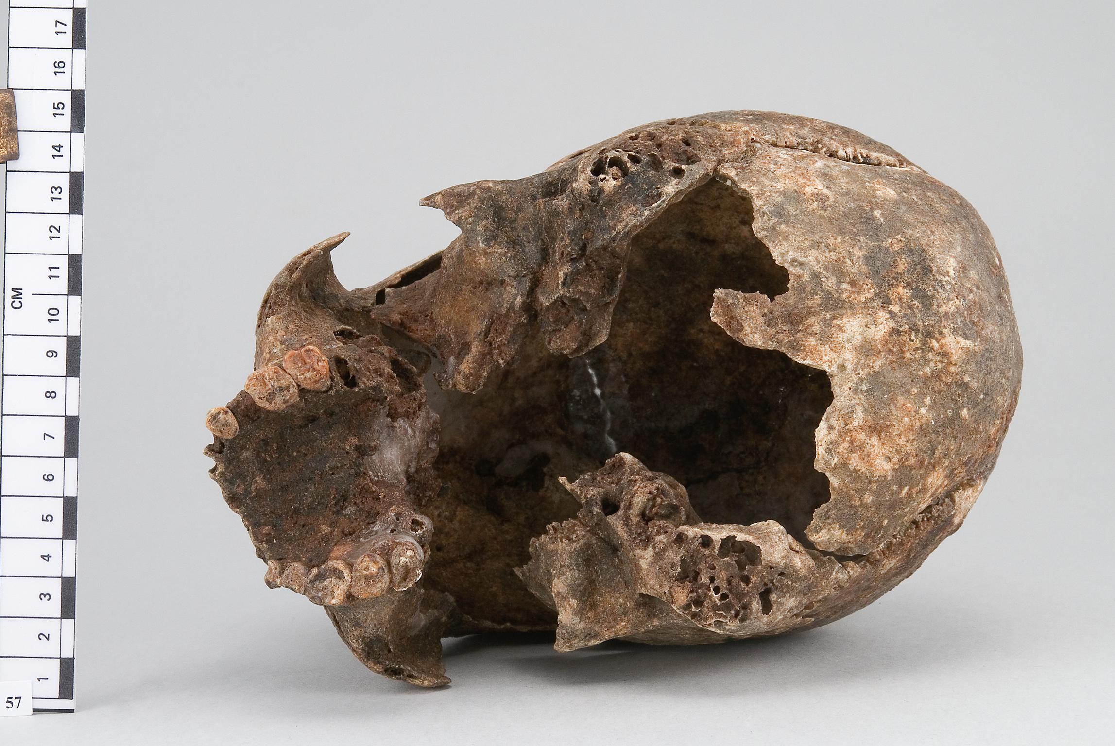 Neolithic human remains