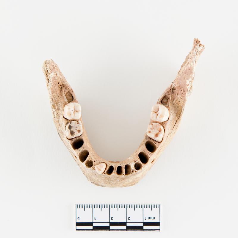 Neolithic human remains