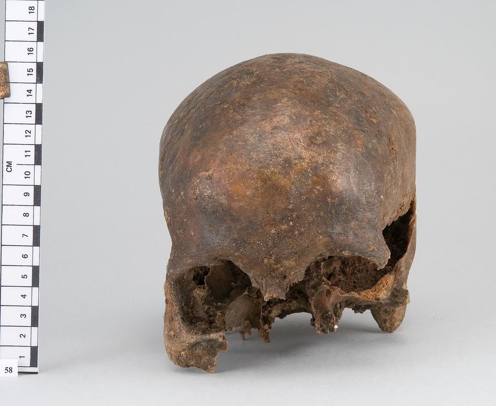 human skull