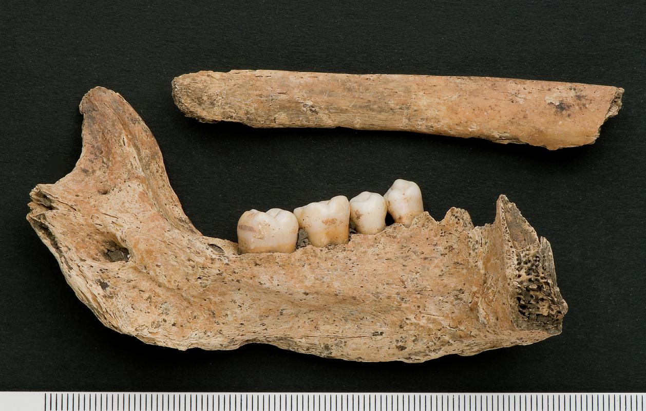 Early Medieval human remains