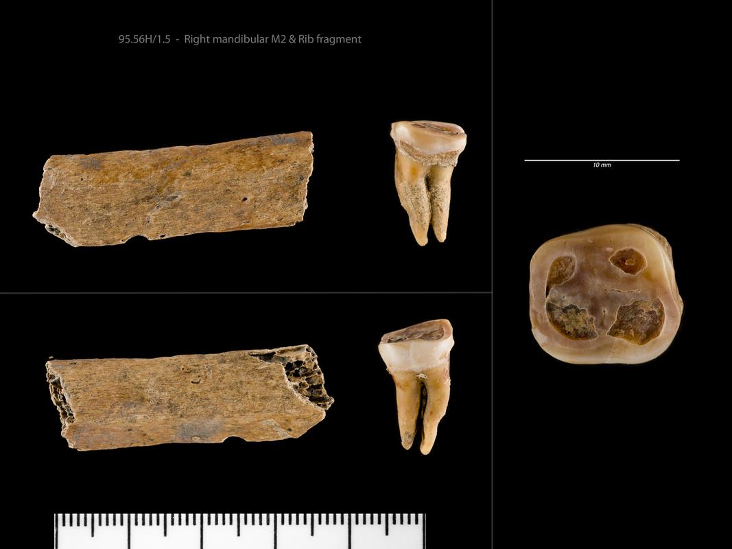 Early Medieval human remains