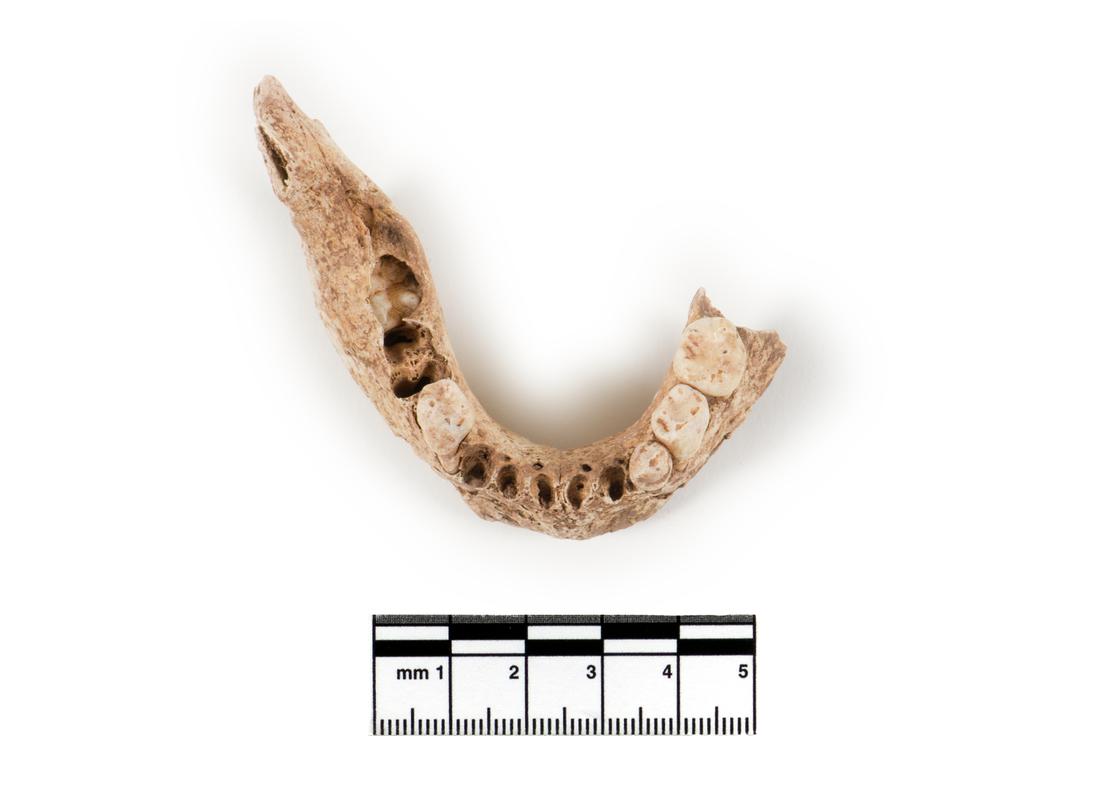Neolithic human remains