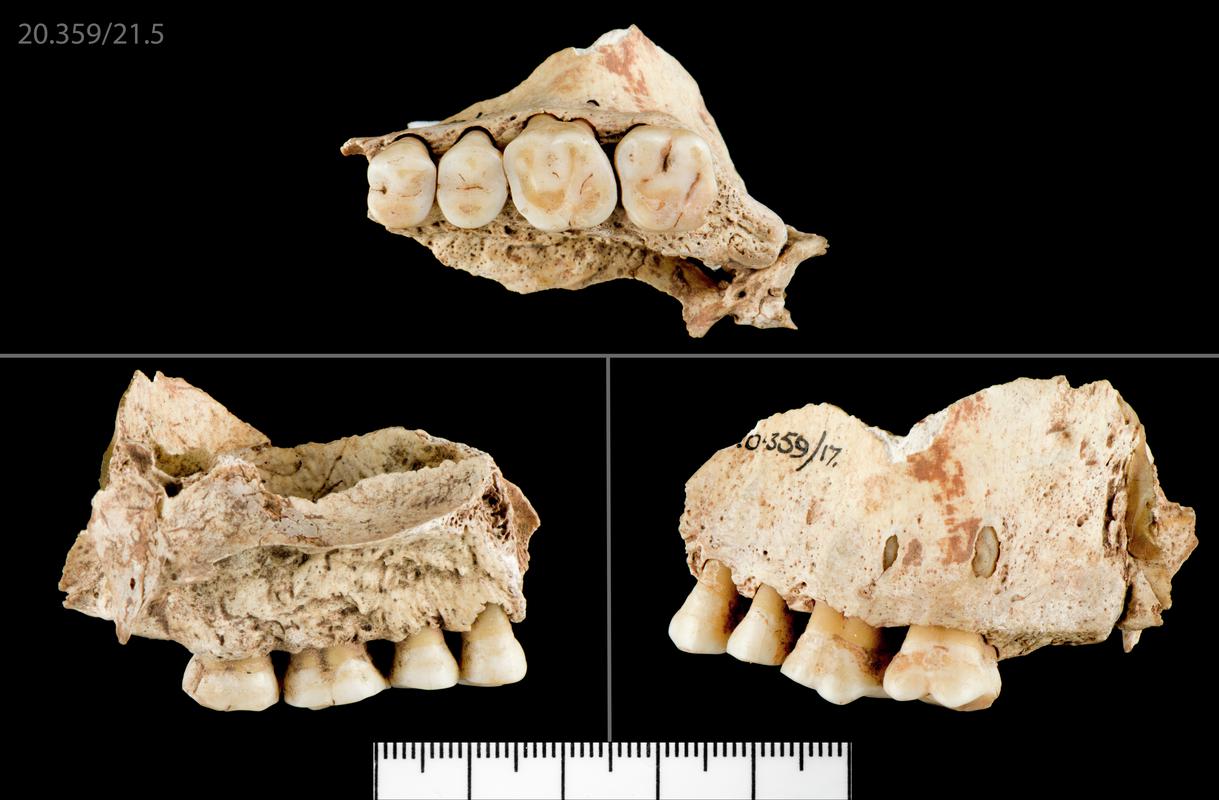 Human remains - upper right second molar