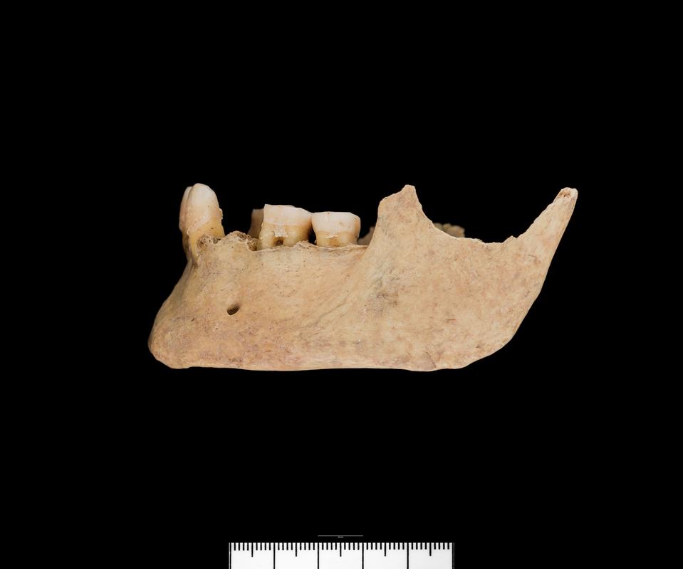 Bronze Age human remains