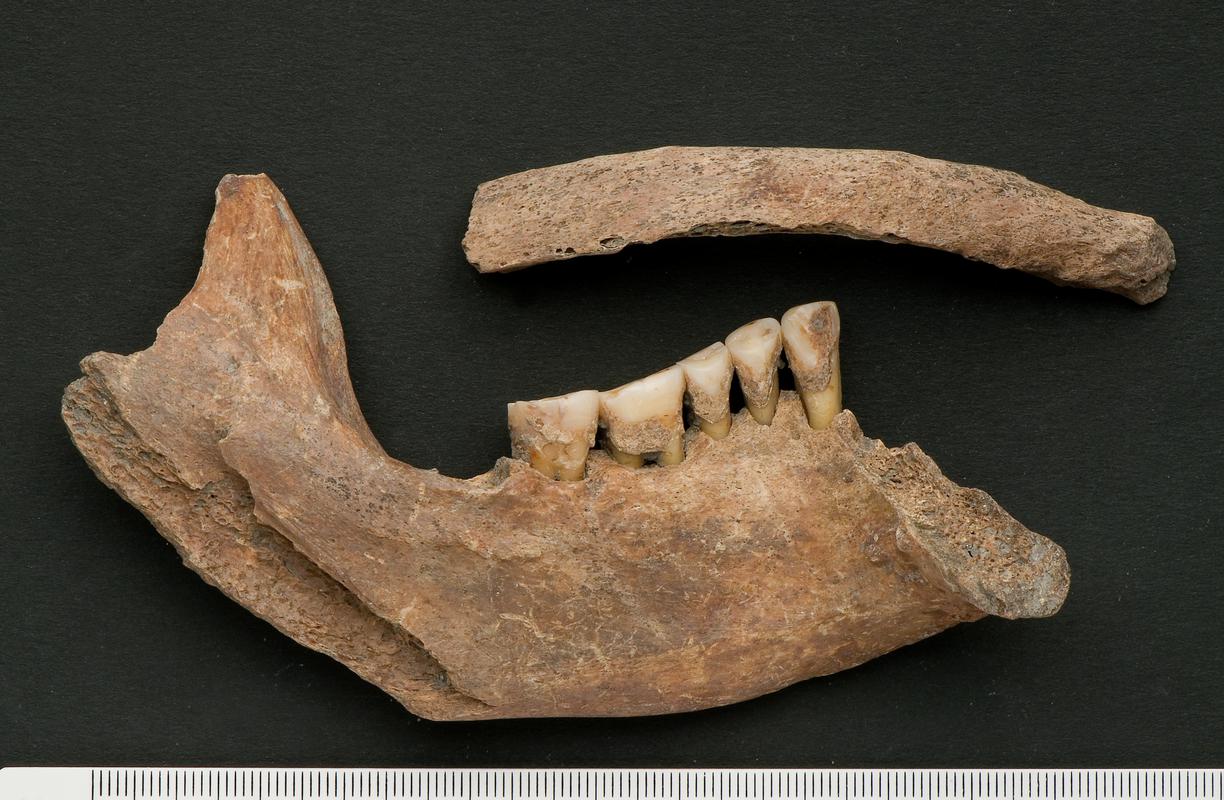 Left upper second molar - human and rib