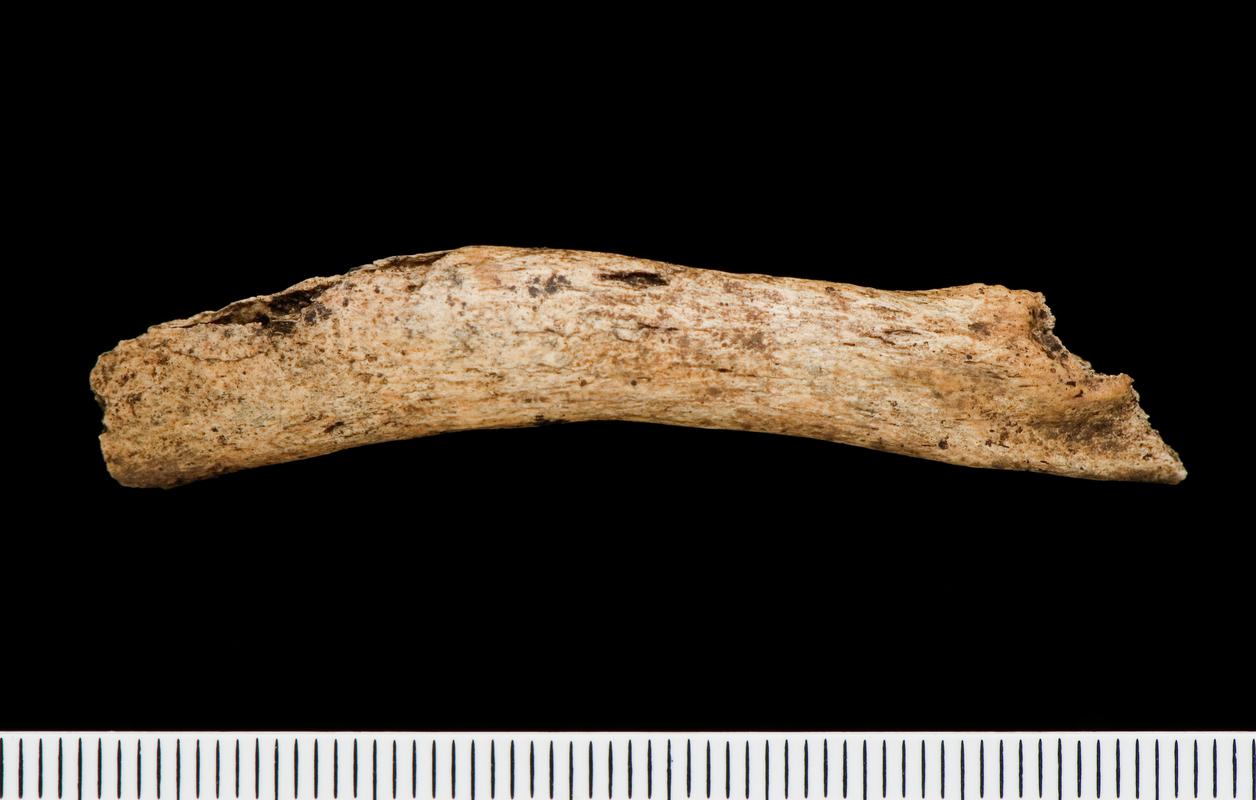 Early Medieval human remains