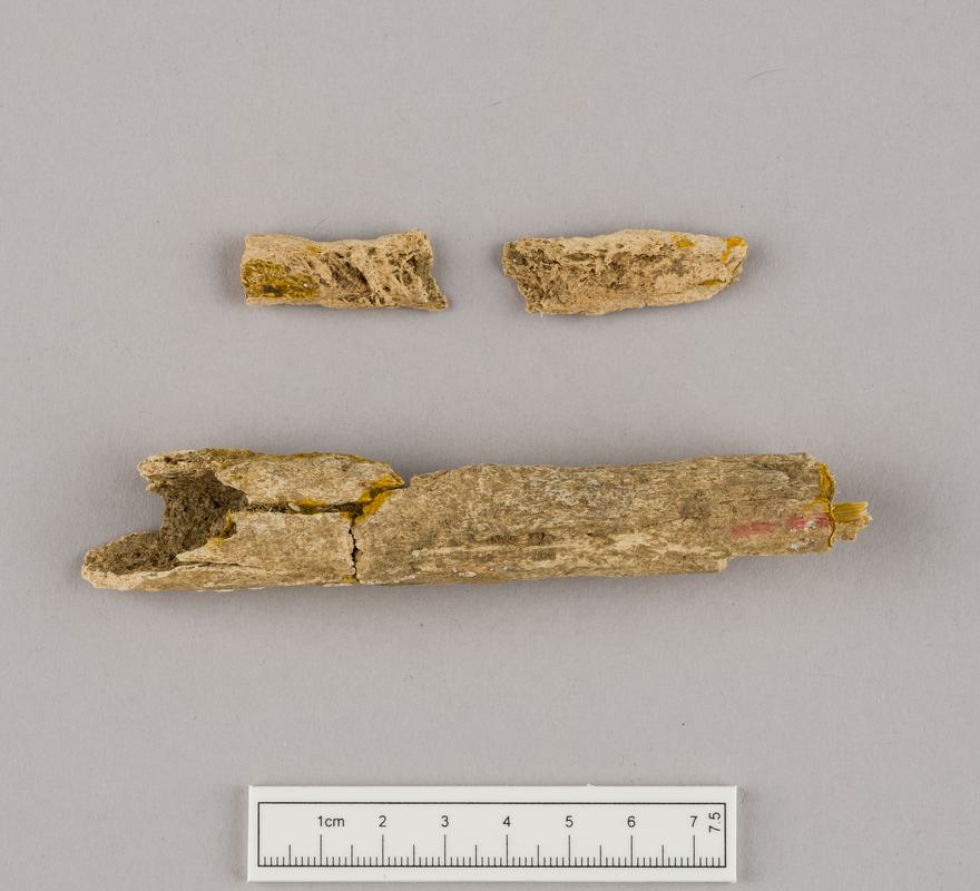 Undated human remains