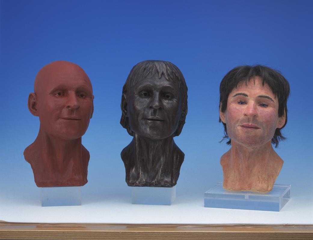 reconstruction heads