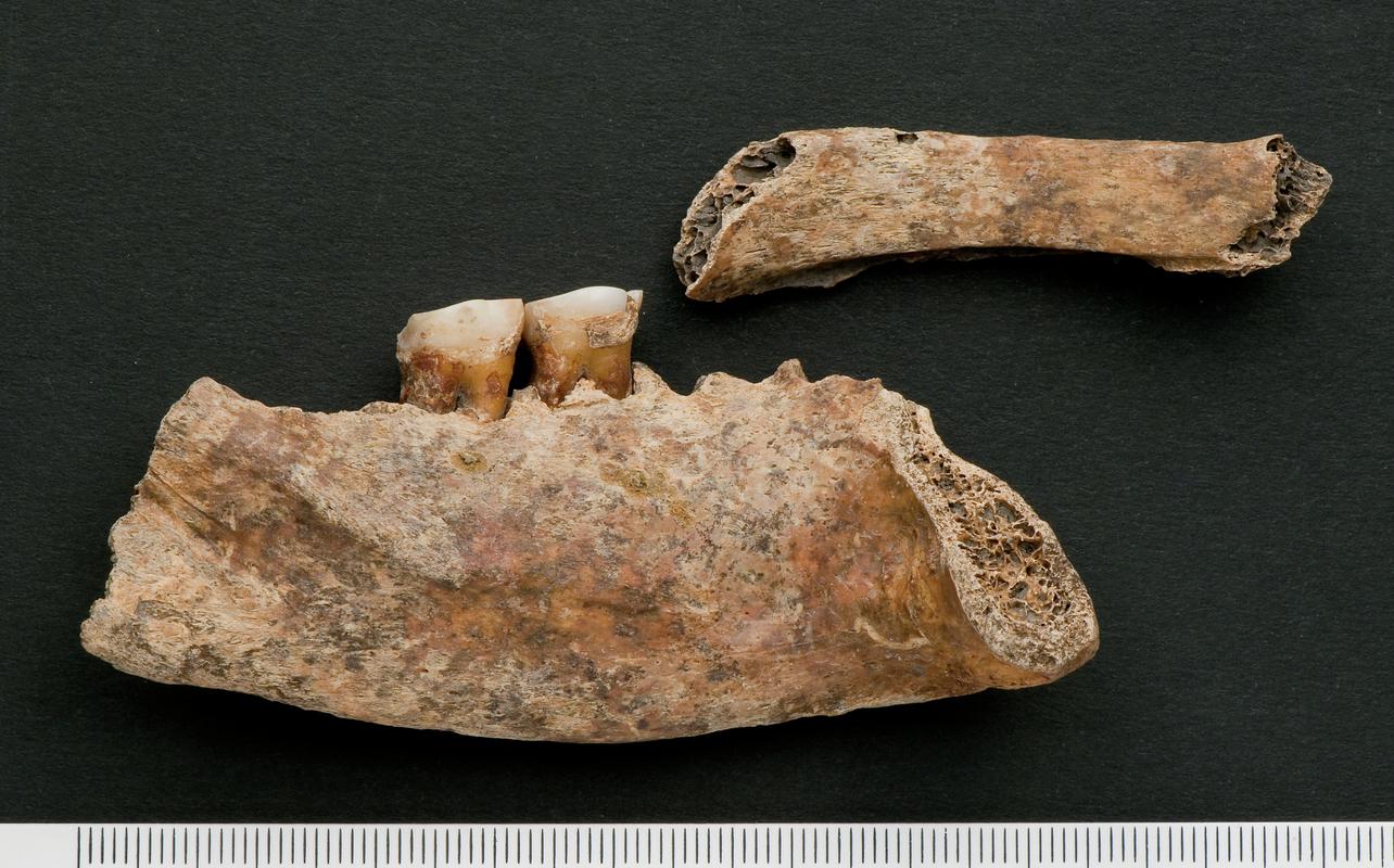 Early Medieval human remains