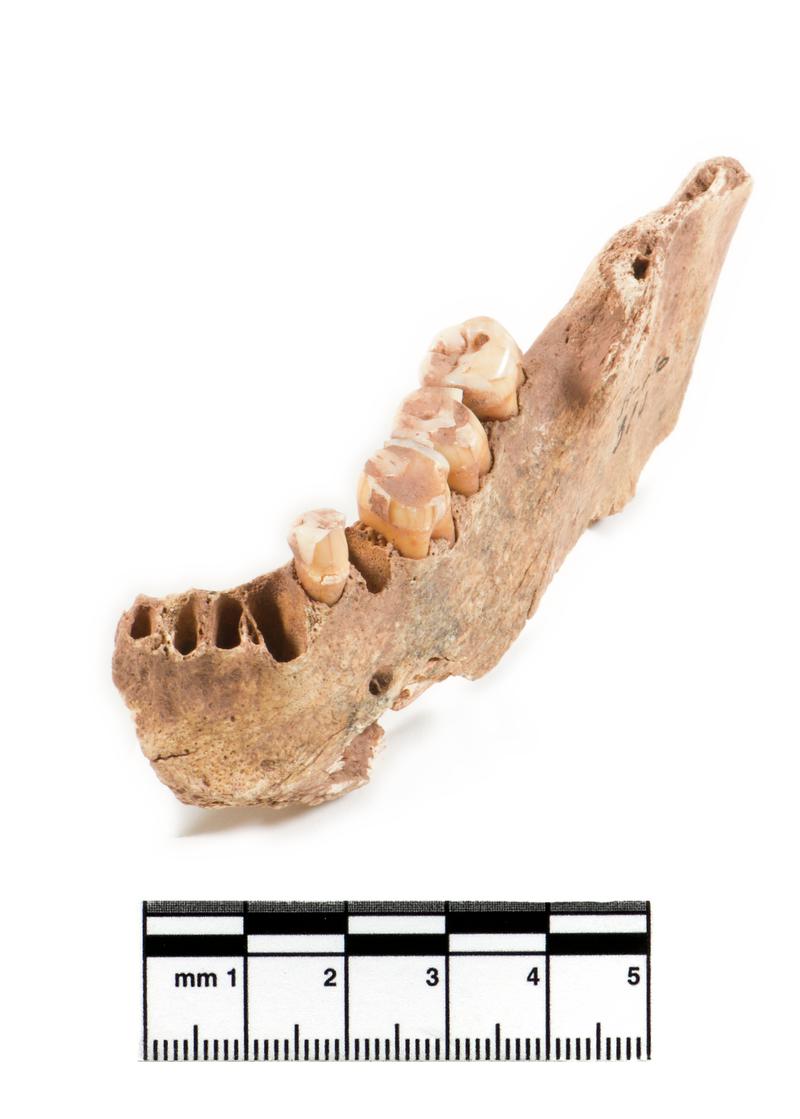 human mandible