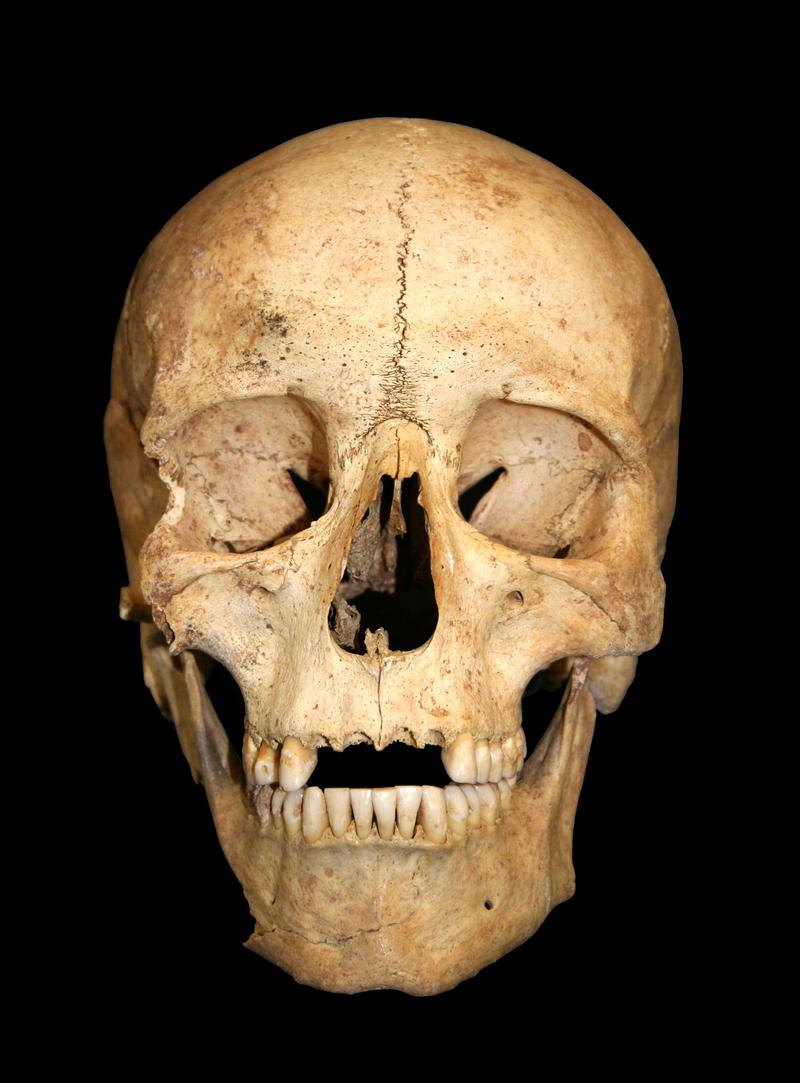 Neolithic human remains