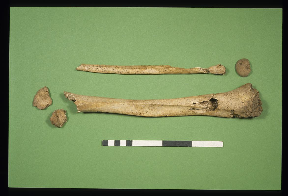 Early Medieval human remains