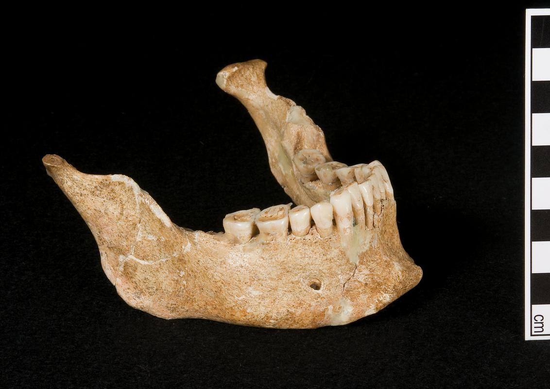 Early Medieval human remains