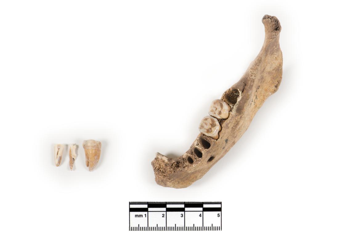 Neolithic human remains
