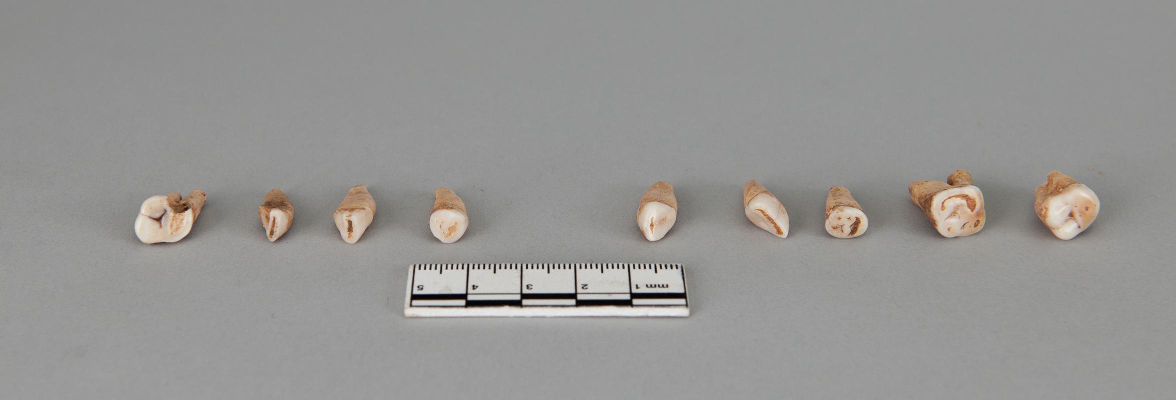 Early Medieval human remains