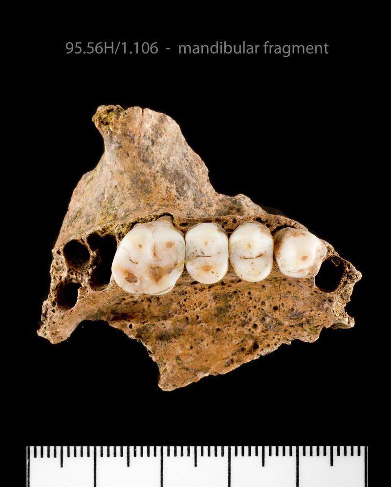 Early Medieval human remains