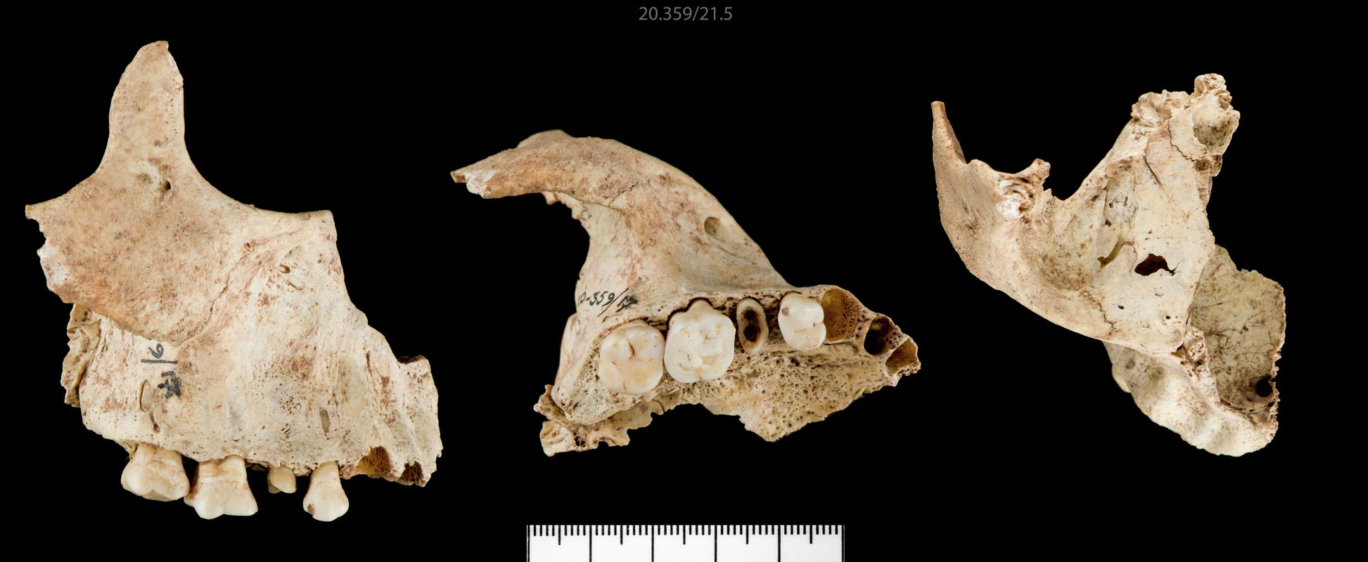 Prehistoric human bone