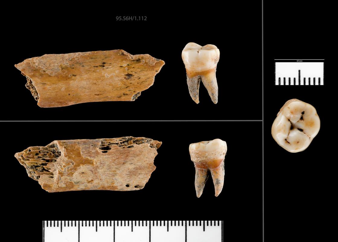 Early Medieval human remains