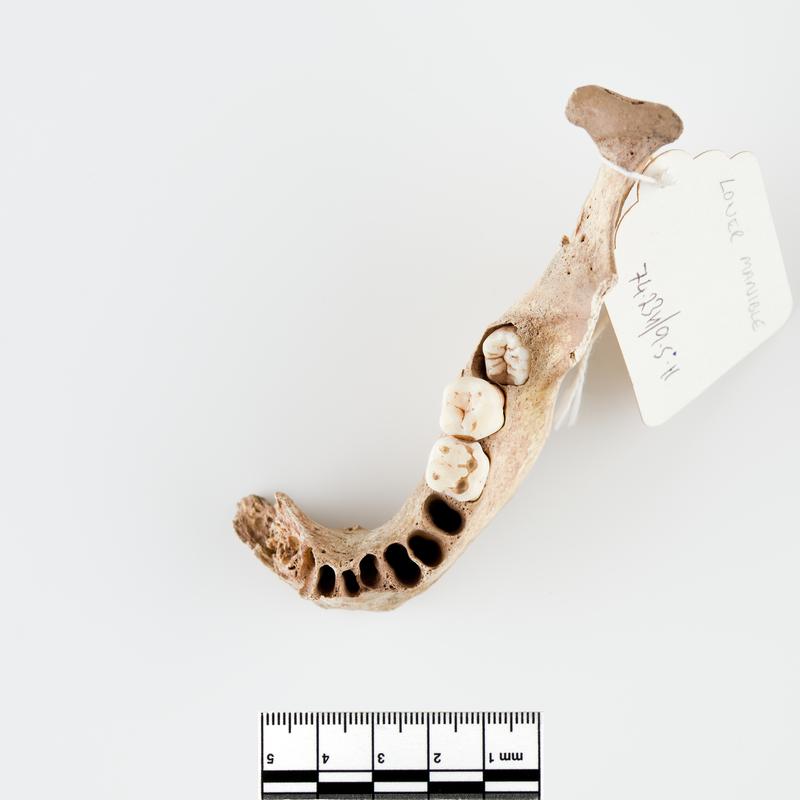 Neolithic human remains