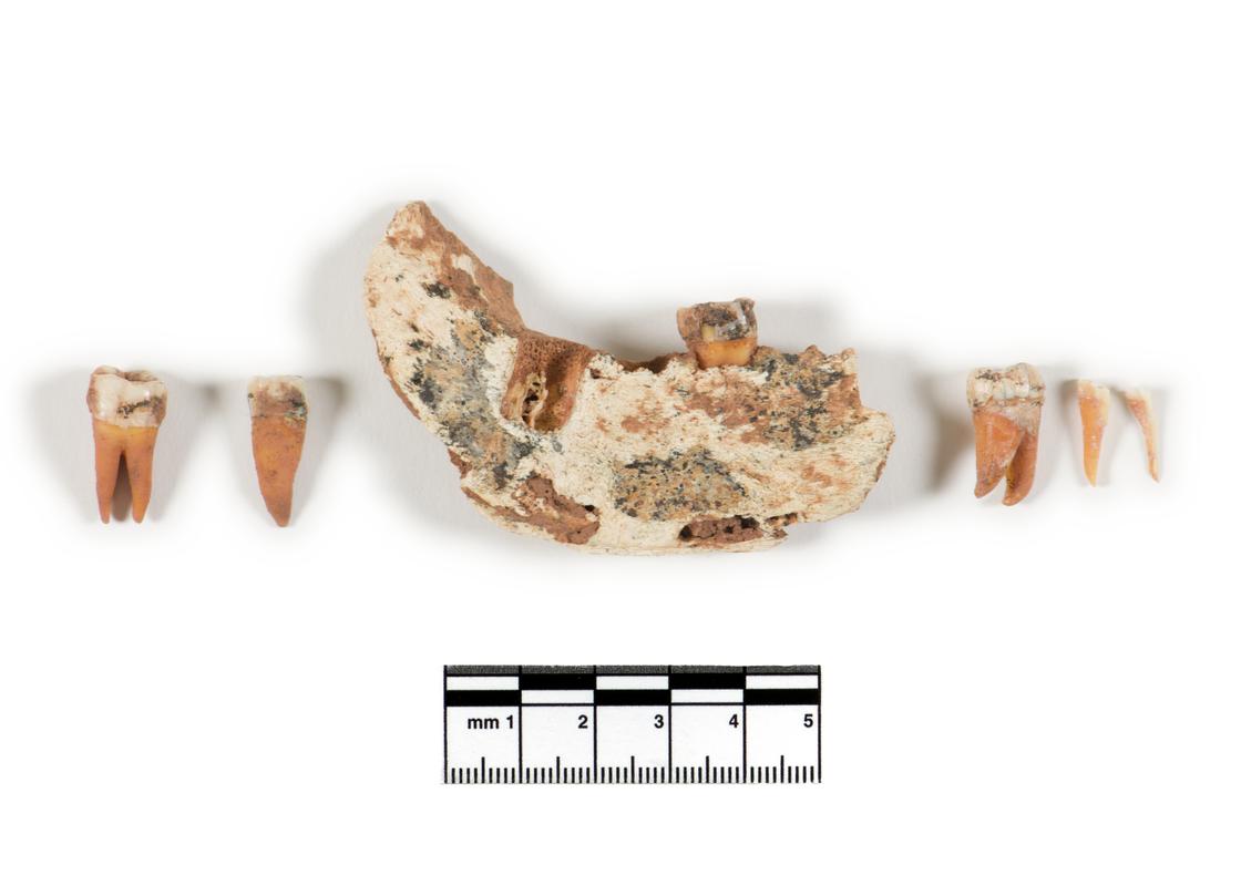 Neolithic human remains