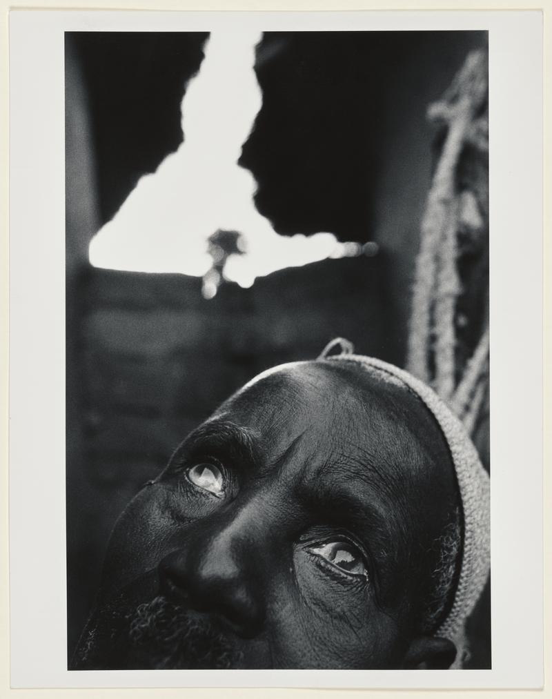 Elder with river blindness, Mali
